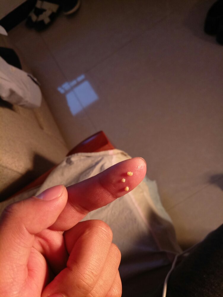 嘴里吐出来的黄色像小米粒一样的东西,捏碎还挺臭的,是什么?