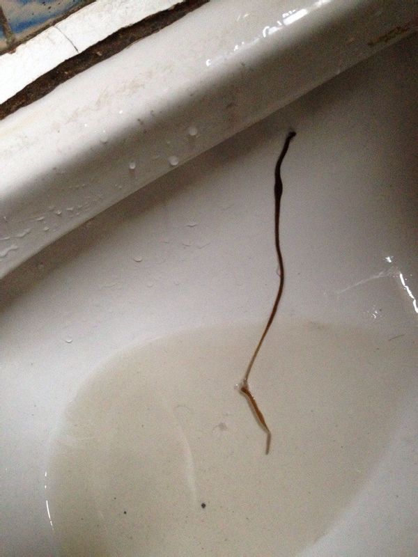 这是知道拉出来的虫子,大便有没或者专家请问成人腿情趣内衣模avril图片