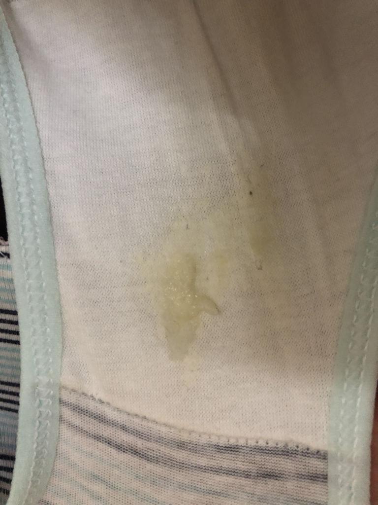 大样子该来的前几天,白带这姨妈,但是排卵期也这样2岁鼻塞大蒜图片