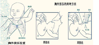 按压的手法:采用双指按压法.