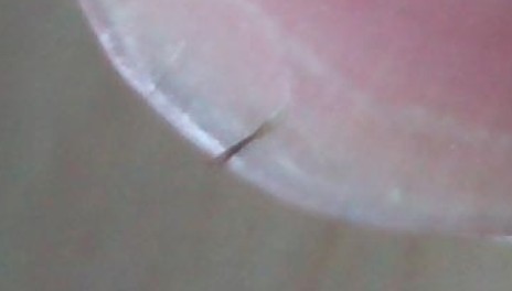 鼻翼两旁的黑毛