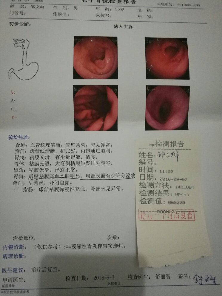 急性糜烂性胃炎一般住院治疗过程是怎样的
