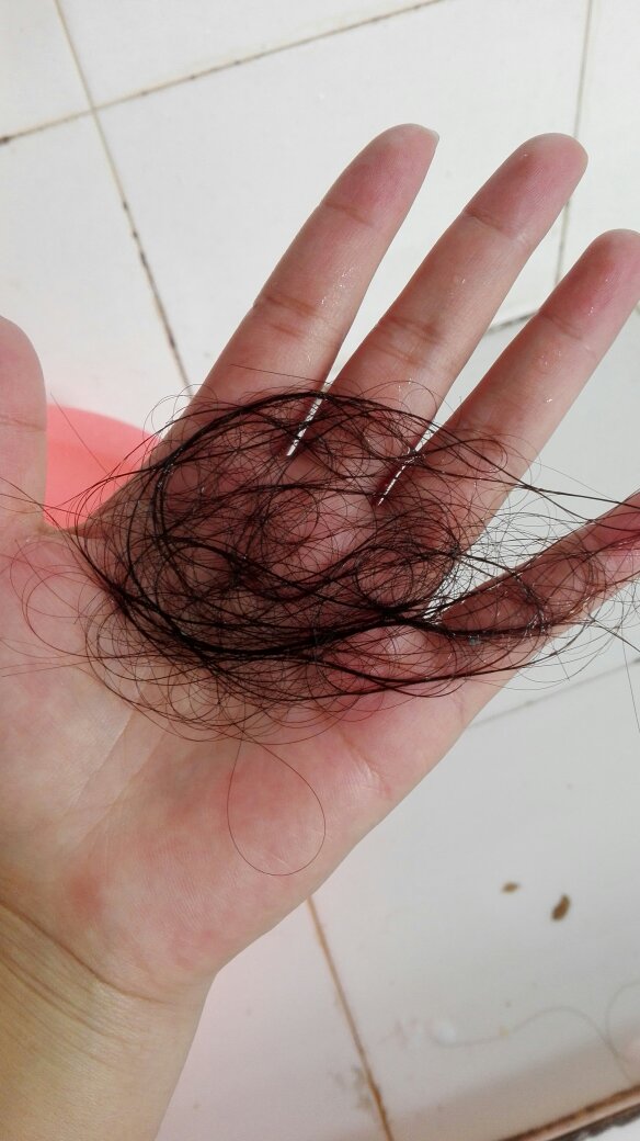 从女生的时候开始掉,掉的比这个还多,现在大一了依旧没好转,本来笑高三起来的好看图片