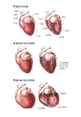 完全性大血管转位,主动脉缩窄,动脉导管未闭及心内膜垫缺损