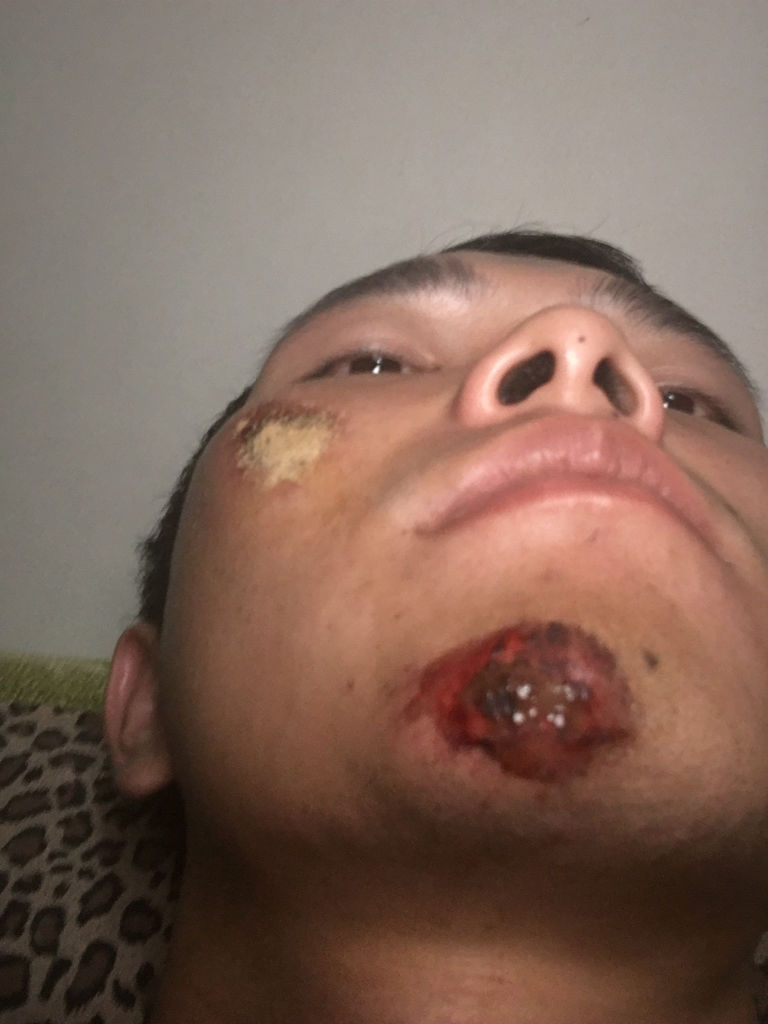 而且好像一直在流血还是什么东西.