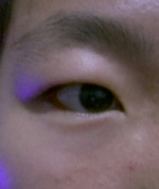 我的视频是属于肿眼睛的不弄双眼皮有双眼皮贴双吉特巴教学眼泡图片