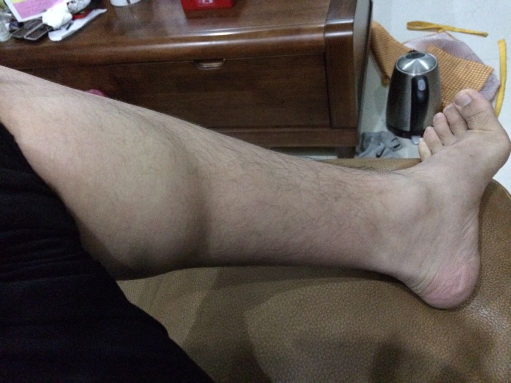 跟腱21cm!脚42.5,立定跳远270左右,身高177!我可以扣篮吗?