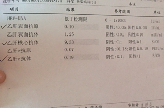展开全部 这种情况说明你的乙肝正在恢复,抗原阴性就是疾病就要好了