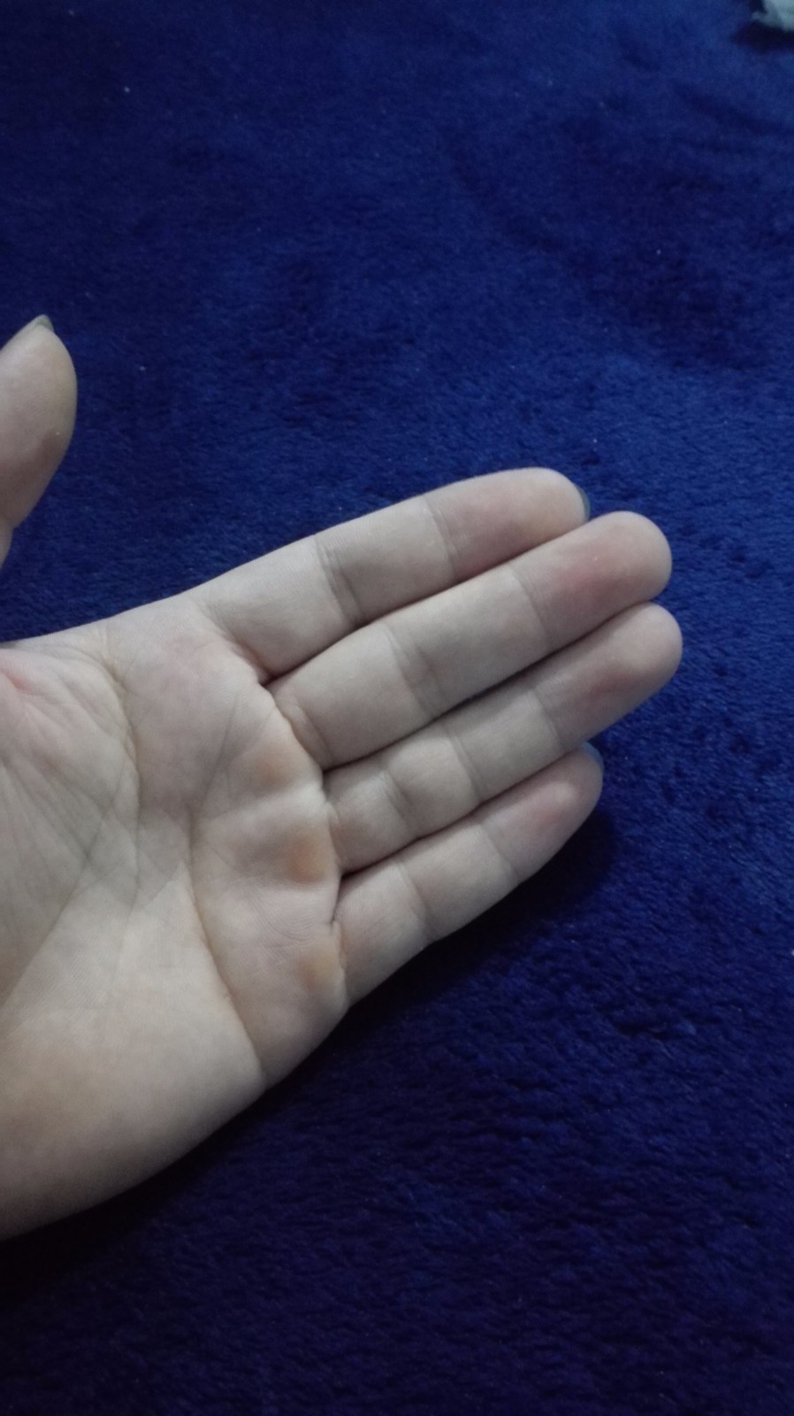 左手无名指四个关节能不能解释一下