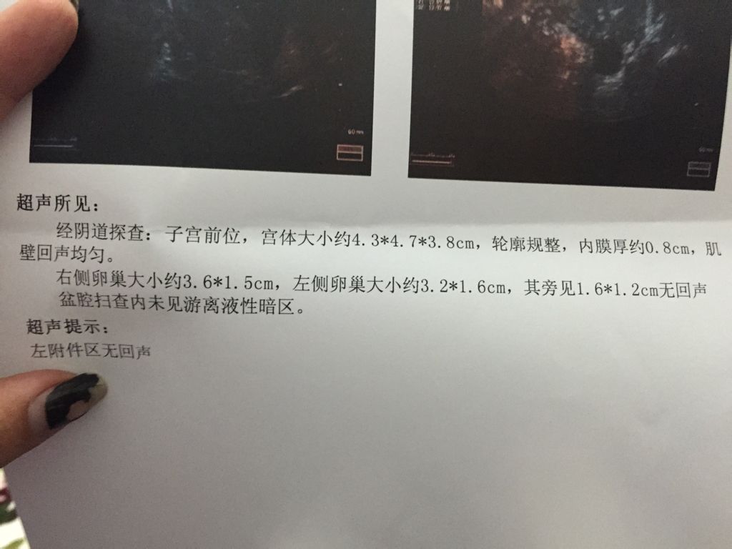 女性左小腹部疼痛,女性左小腹部疼痛的原因有哪些-第4张图片-Otaku Male Knowledge 女性左小腹部疼痛,女性左小腹部疼痛的原因有哪些-第4张图片-Otaku Male Knowledge