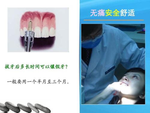 老年人口腔保健ppt_老年人口腔保健ppt下载