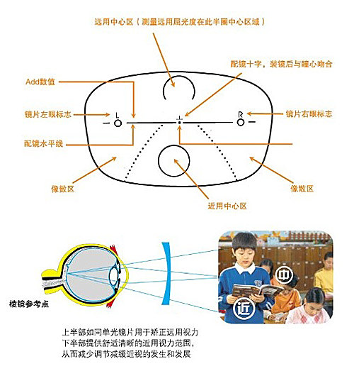 渐进镜片多少度,渐进镜片的优缺点
